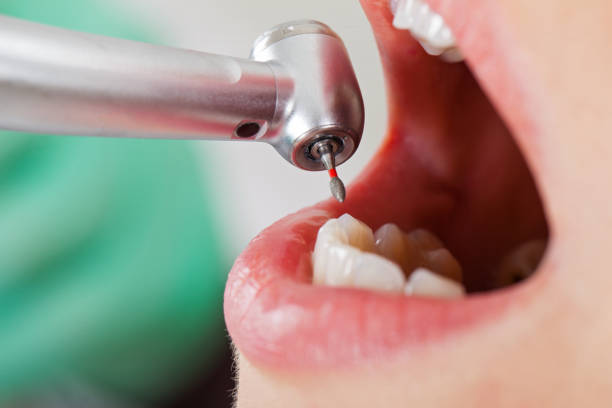 Best Walk-In Emergency Dentist in Moulton, AL